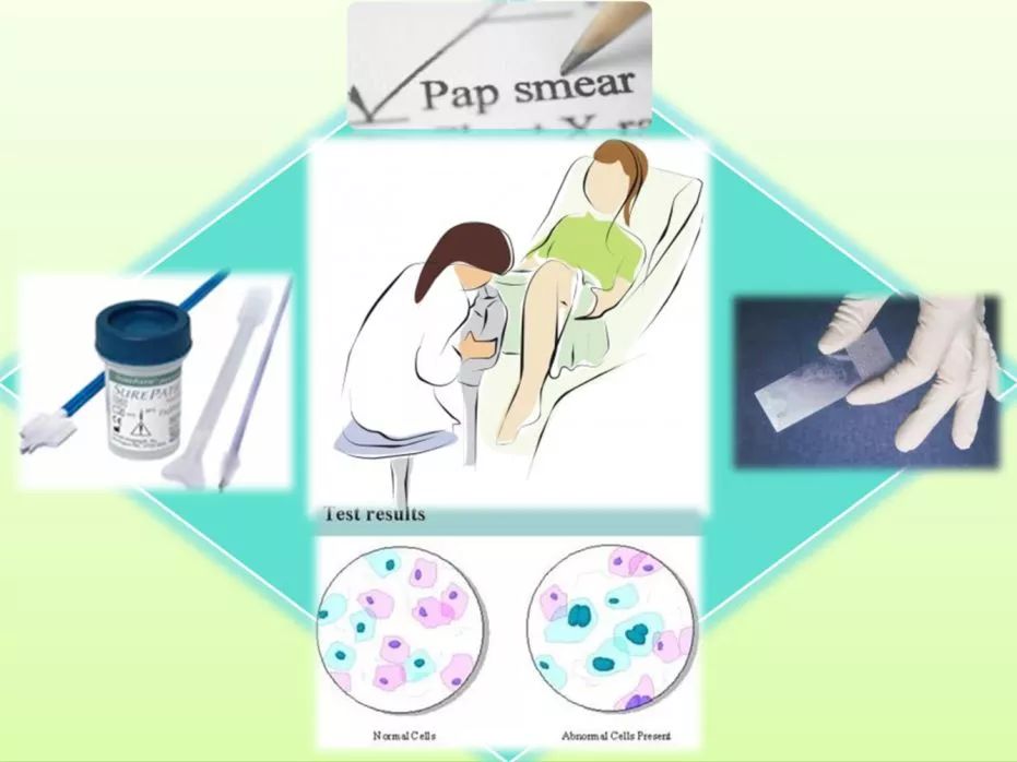 HPV疫苗摇不到号怎么办，完全佛系不在乎