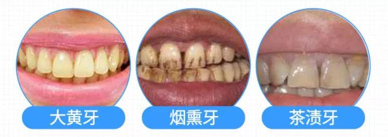 韩国钻石美白牙齿的牙膏好用吗,韩国牙膏排名第一名儿童