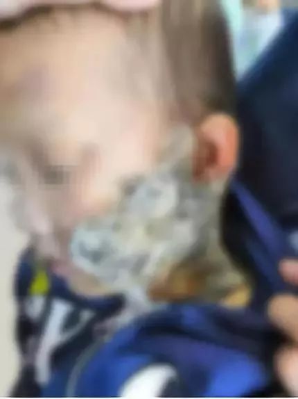 头骨磨粉治精神病?生吃蝌蚪强身健体?“保健神招”害人呀!