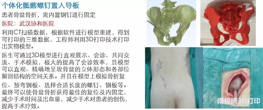 “普逻迈”——三的部落隆重推出数字医疗中文品牌