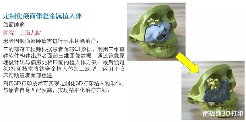 “普逻迈”——三的部落隆重推出数字医疗中文品牌