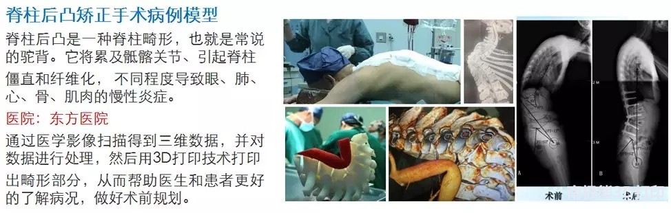 “普逻迈”——三的部落隆重推出数字医疗中文品牌