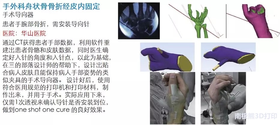 “普逻迈”——三的部落隆重推出数字医疗中文品牌