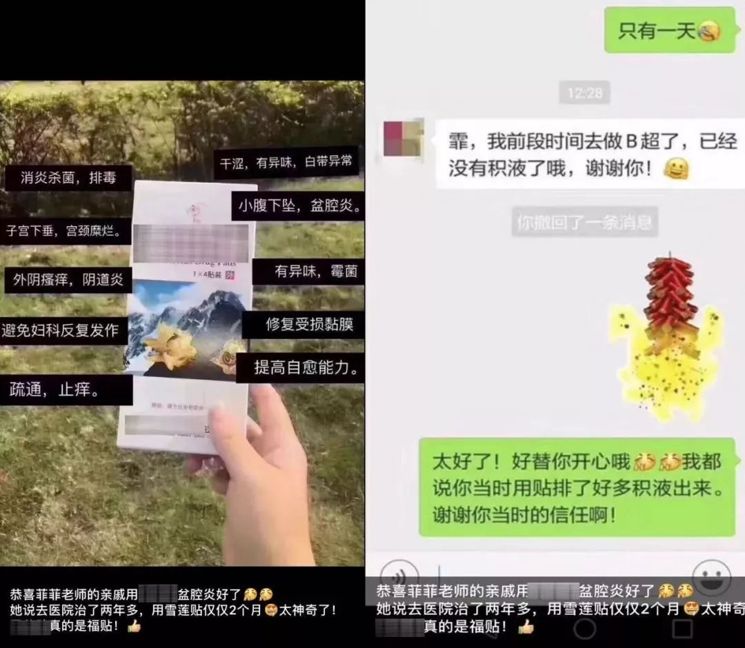 姨妈巾治百病,包治百病的姨妈巾
