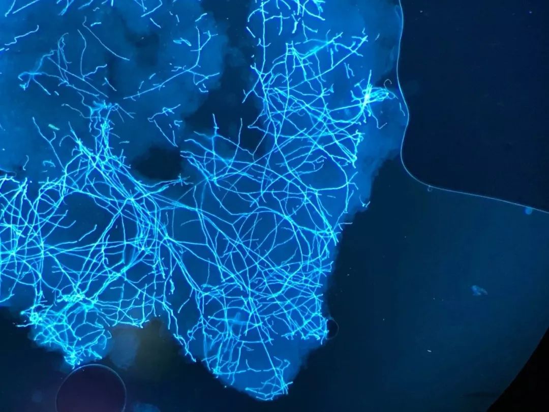 猫癣传染了给人该怎么办,人被传染上猫癣能用皮特芬吗