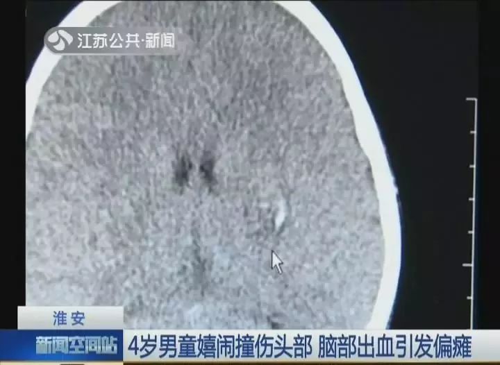 1岁女孩摔下意外死亡,1岁女婴从3楼摔落生命垂危