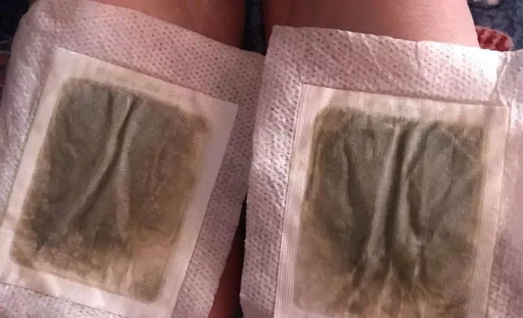 每晚一贴祛除湿气,每天一贴瘦全身