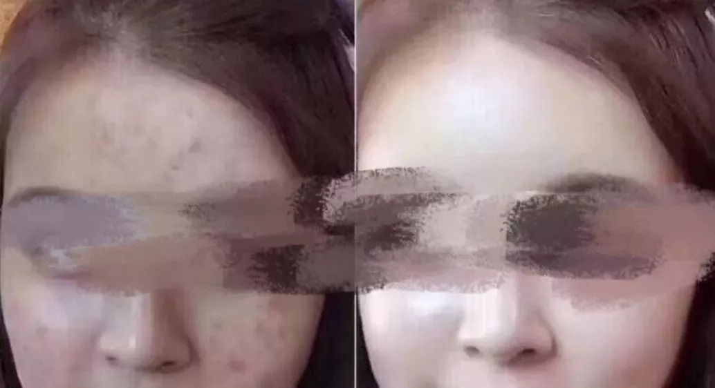 每晚一贴祛除湿气,每天一贴瘦全身