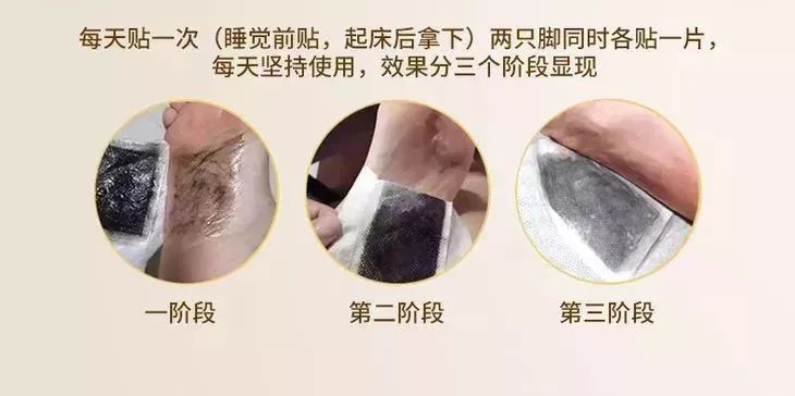 每晚一贴祛除湿气,每天一贴瘦全身