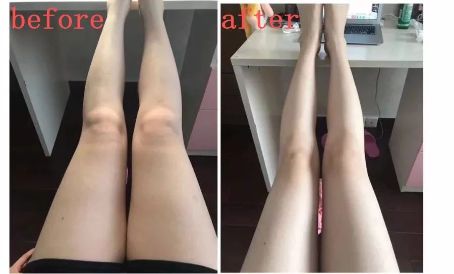 刘涛、沈月塑形私教:每天15分钟,教你轻松打造一双长白细直性感美腿