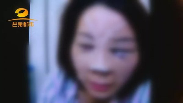 瞒着老公贷款40万,瞒着老公去隆鼻会有什么后果