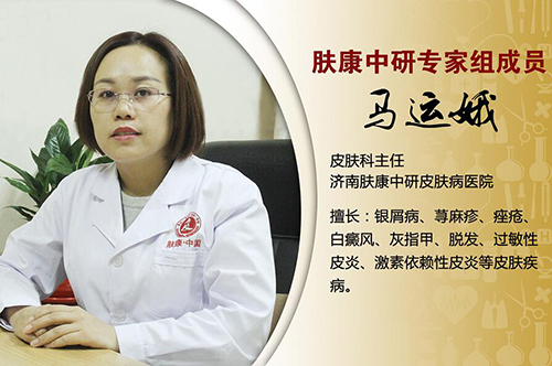 女性脱发连根一起掉严重10个原因,脂溢性脱发是什么原因引起的啊