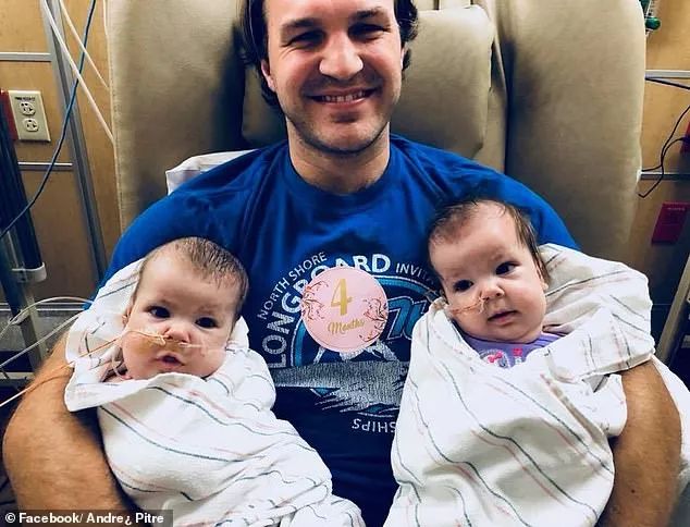 这对要上牛津剑桥的美女姐妹花，16年前是连体婴！存活率仅百万分之一