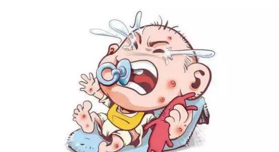 水痘进入高发期这些“战痘”知识你不能不知道