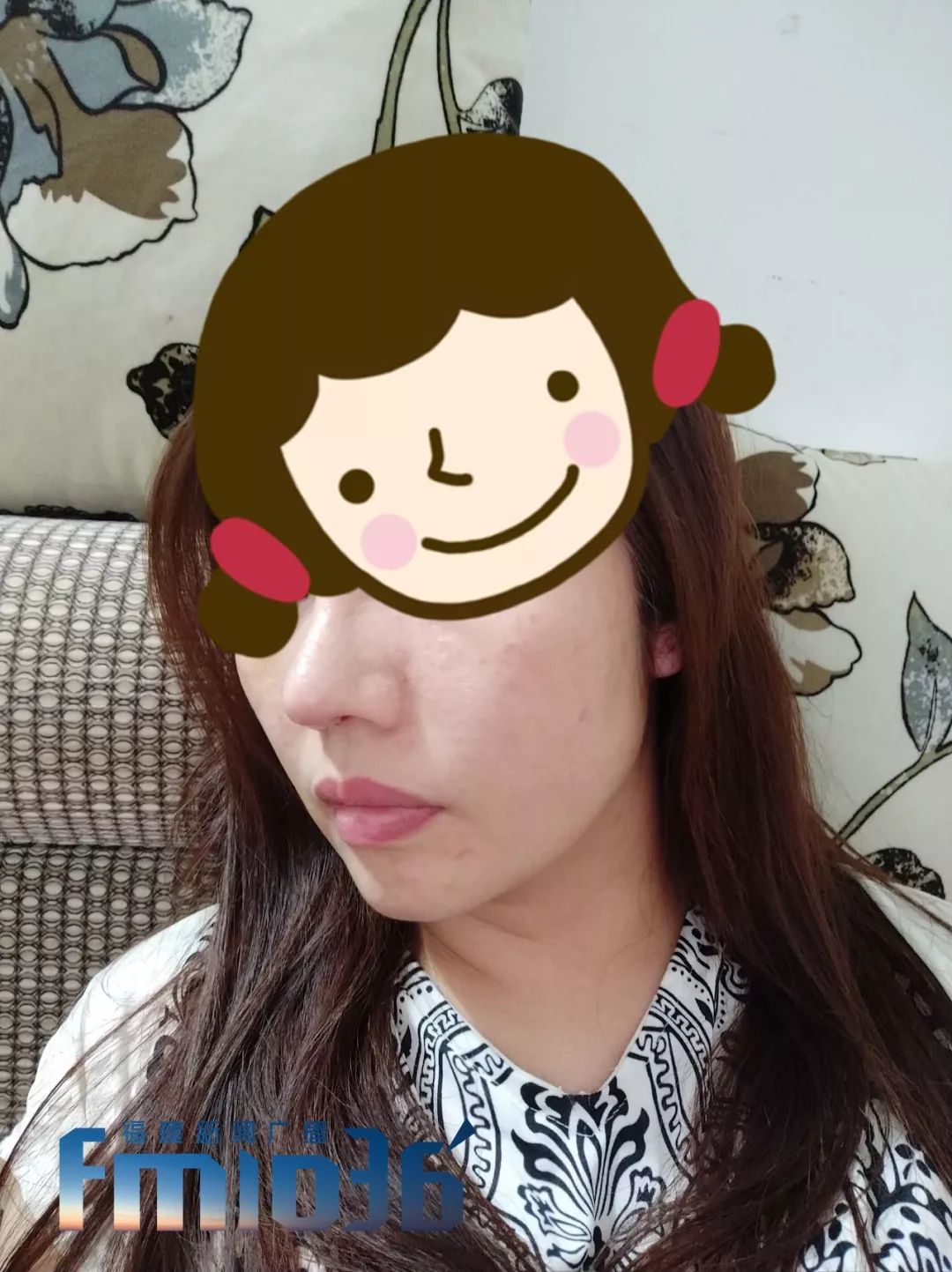 福州一女子整容失败,福州女子整形失败