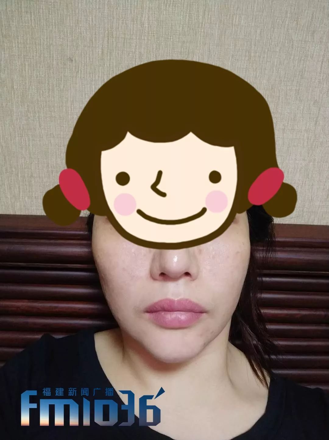 福州一女子整容失败,福州女子整形失败