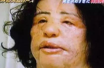 又一花季少女因整形死亡，这些都是前车之鉴……