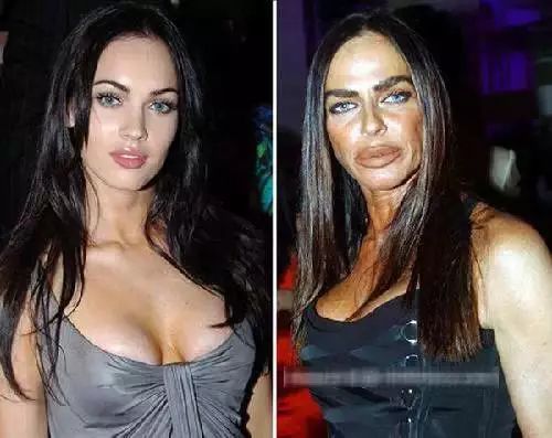 又一花季少女因整形死亡，这些都是前车之鉴……