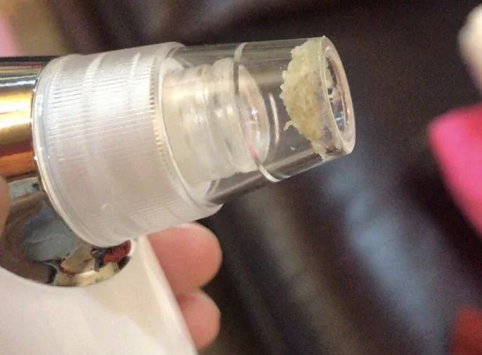 草莓鼻救星怎么治疗,草莓鼻去黑头神器视频