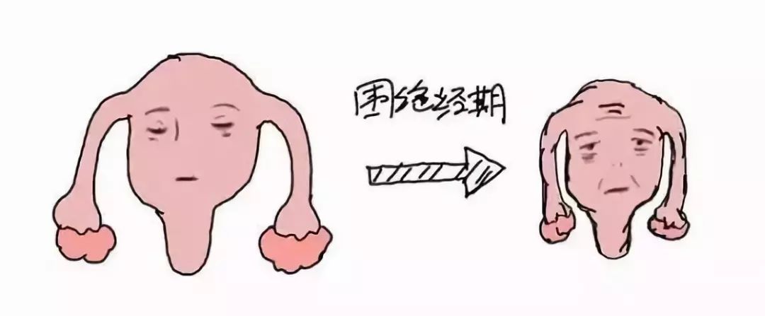 围绝经期综合征5大处方,围绝经期综合征治疗指南