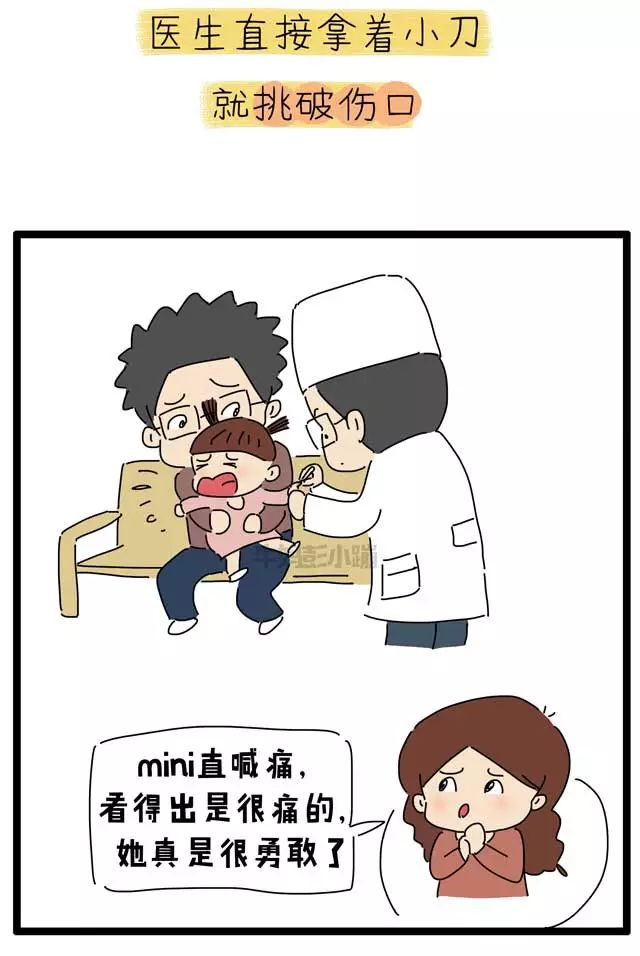 撕倒刺指甲化脓掉了,拔倒刺后指甲脱落