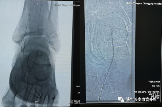教学相长共同成长,北京清华长庚医院周围血管外科