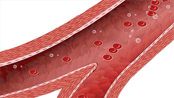堪称医学界的“死神”，你每天做的动作都可能导致这个病！