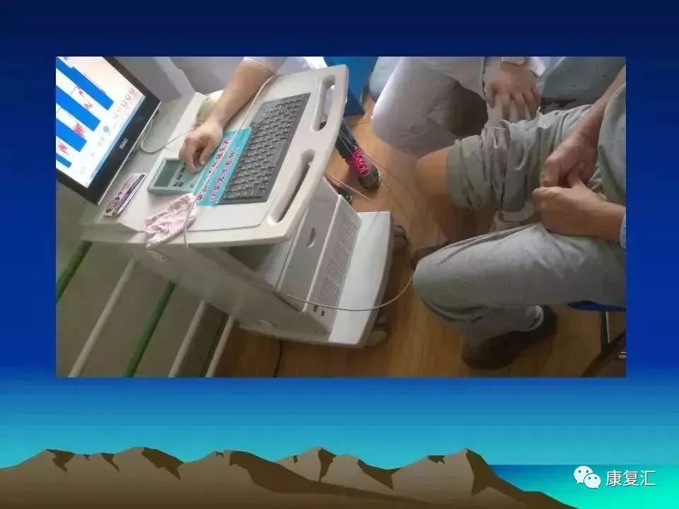 痉挛症可以治疗好吗,痉挛的康复