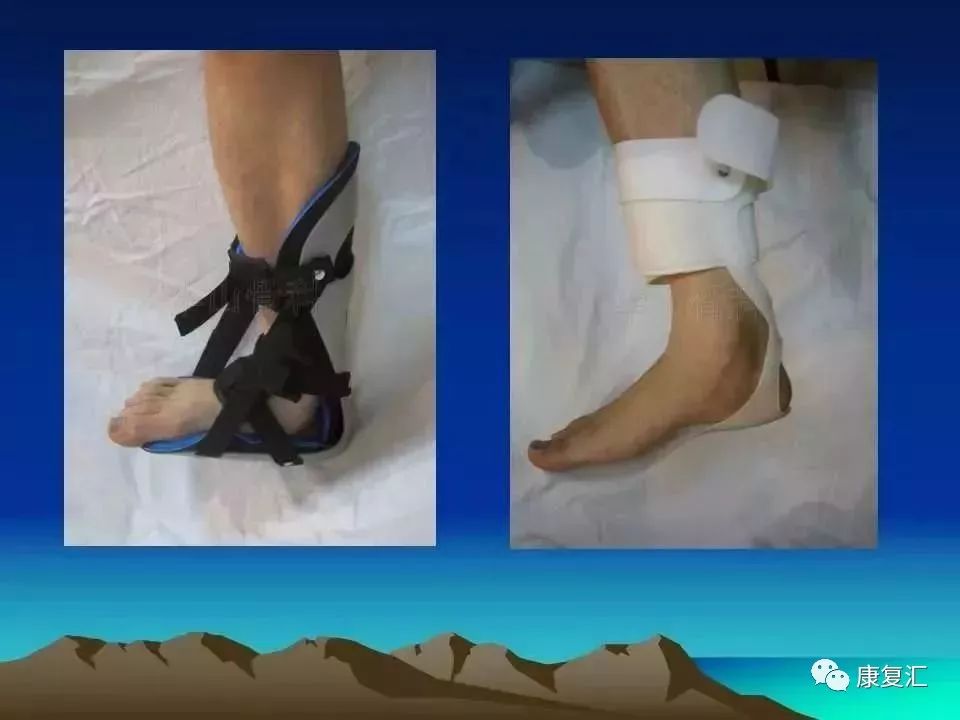 痉挛症可以治疗好吗,痉挛的康复