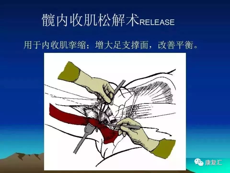 痉挛症可以治疗好吗,痉挛的康复