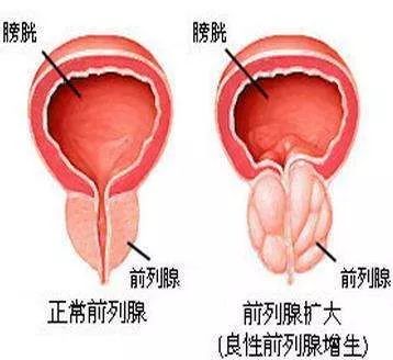 介入科普合集,介入健康科普短视频