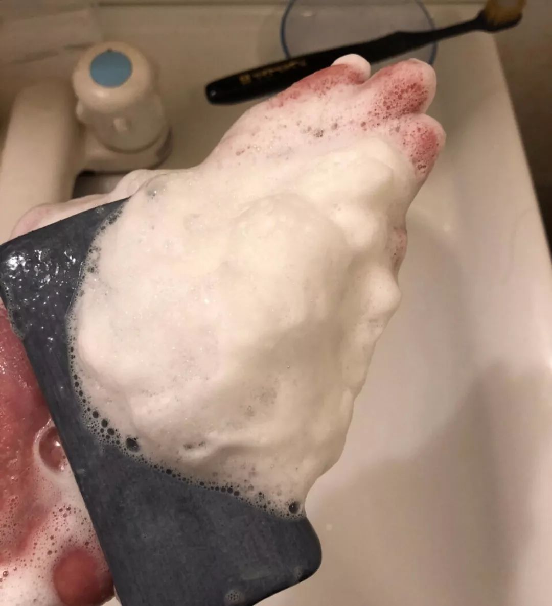 痘痘肌必买药膏有哪些牌子,痘痘肌必看五种痘痘类型