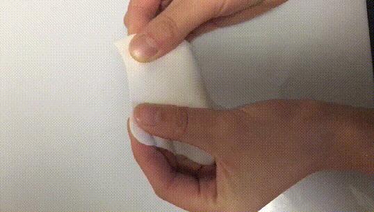 眉间纹抬头纹祛皱效果好吗,祛皱淡纹美容院