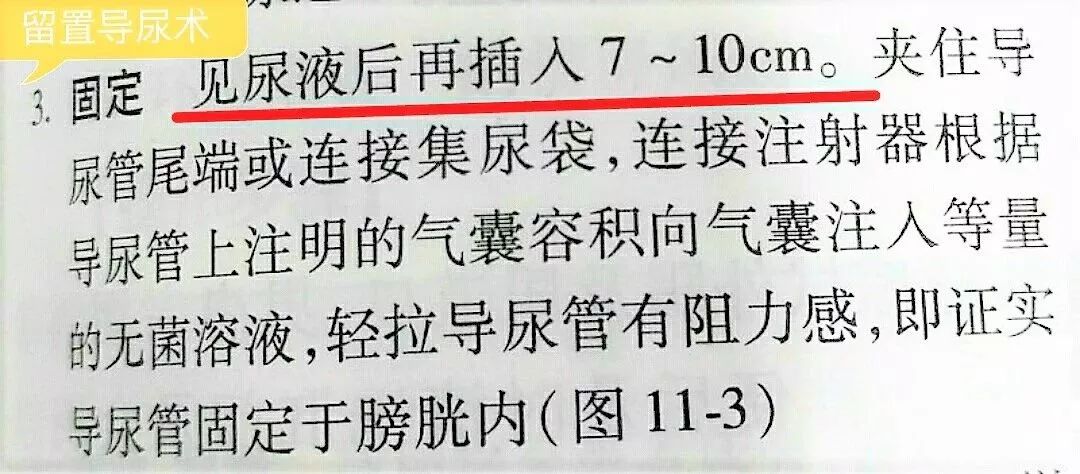 尿管周围漏尿怎么办,留置导尿患者漏尿原因及对策ppt