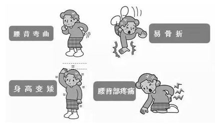 「筋骨堂」骨质疏松症该如何防治？