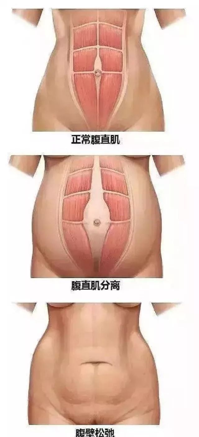 产后肚皮松垮做仰卧起坐有用吗,产后肚皮松垮皱巴巴怎么快速修复