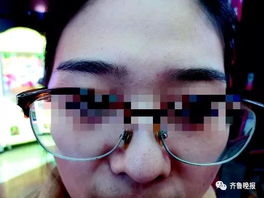 相信文眉开运,济南一女子花8.3万美容!却发现眉毛掉色嘴唇起皮