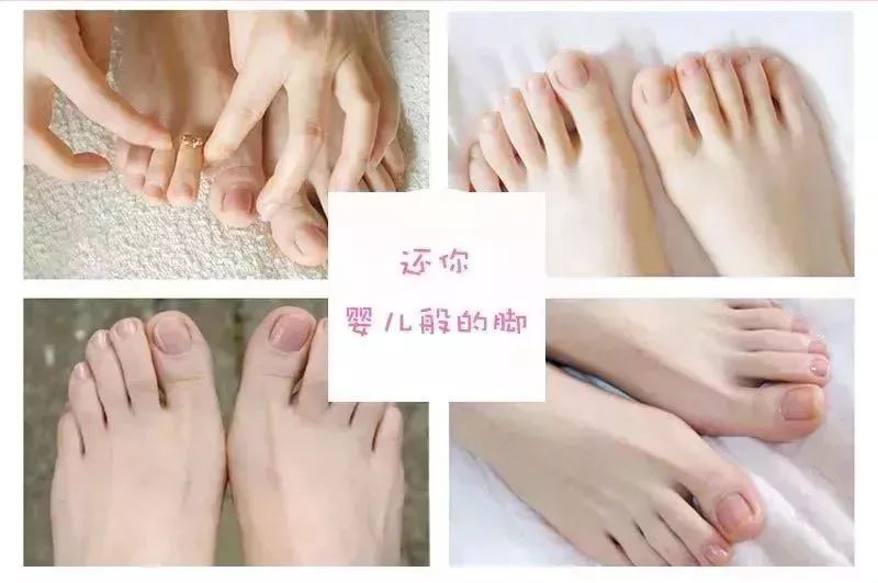 手足脱皮脚后跟干裂修复膏,奇迹第十代