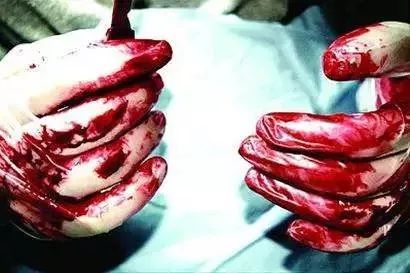 吓！漳州一出租房里，这帮人竟敢摘肾换肾！幕后太惊人……