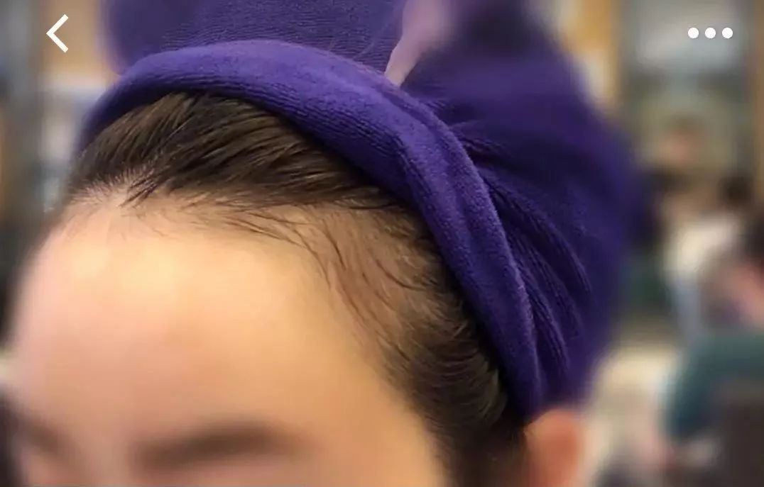 一把梳子拯救你的发际线,拯救发际线神器梳子