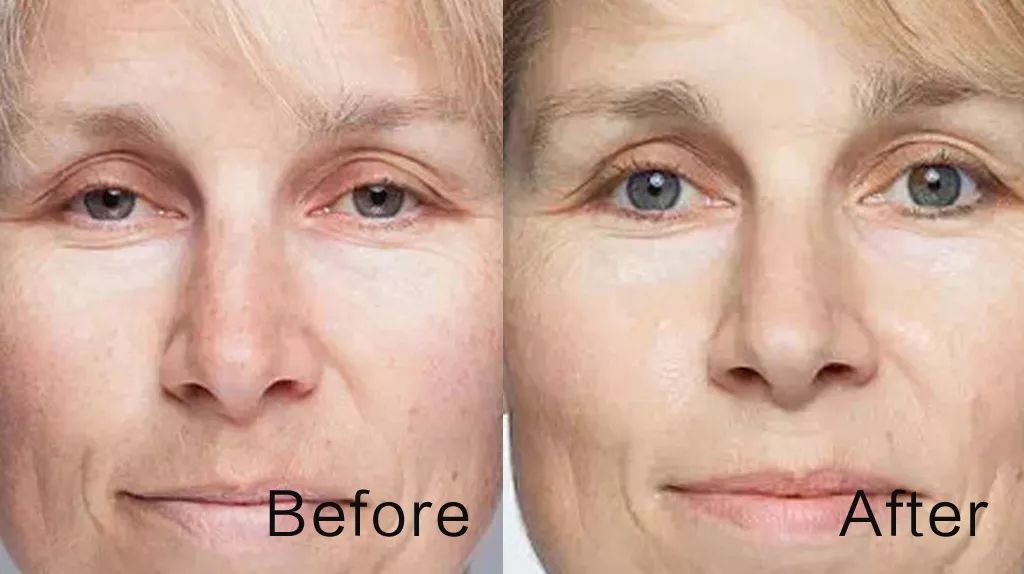 喷一喷睡眠好的用法,喷一喷快速入眠