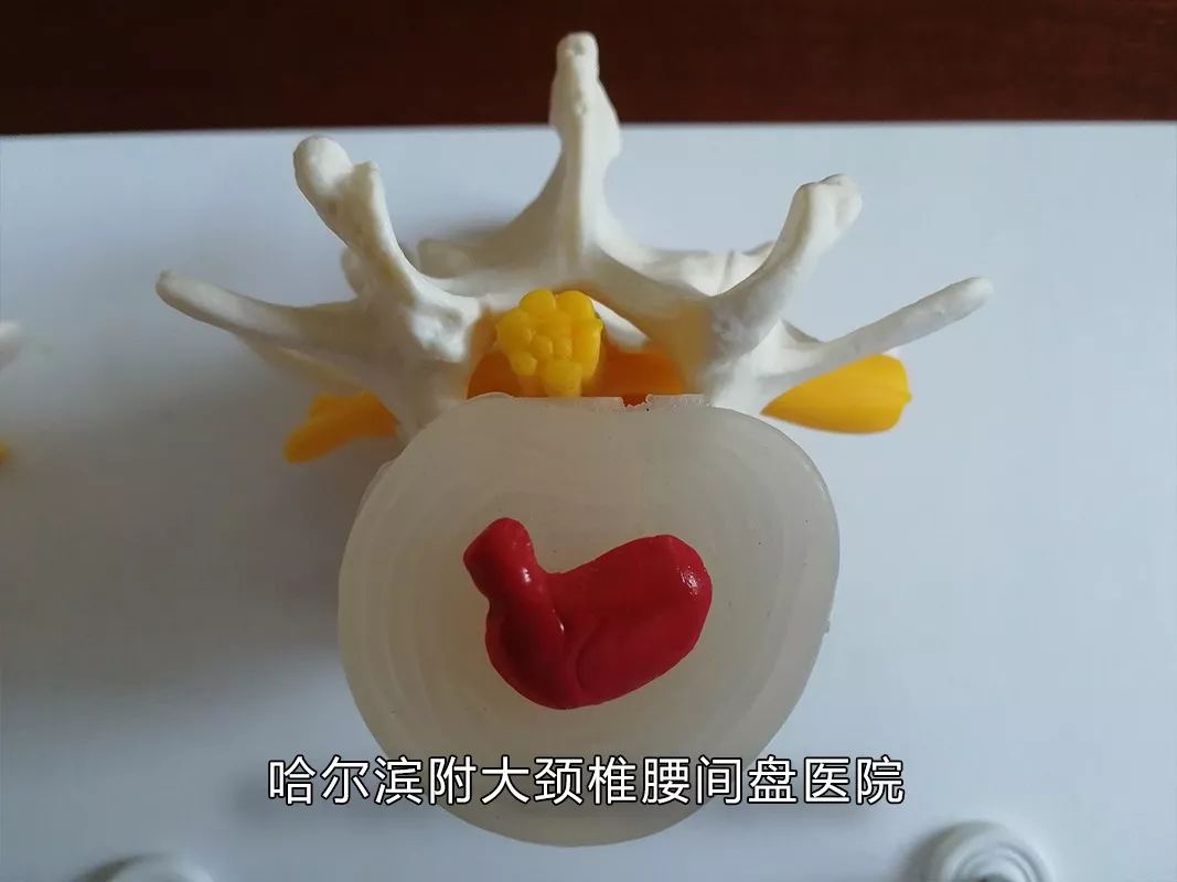 你家睡啥床？你常玩手机？腰痛难忍反复发作、久治不愈，腰间的不能承受之痛该如何缓解？