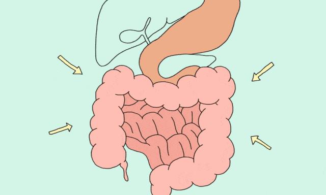 为什么切了息肉，还是会患癌？因为切息肉有时就像割韭菜……