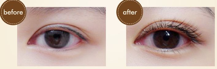 疯狂掉头发发际线后移,疯狂掉头发头发变得稀疏