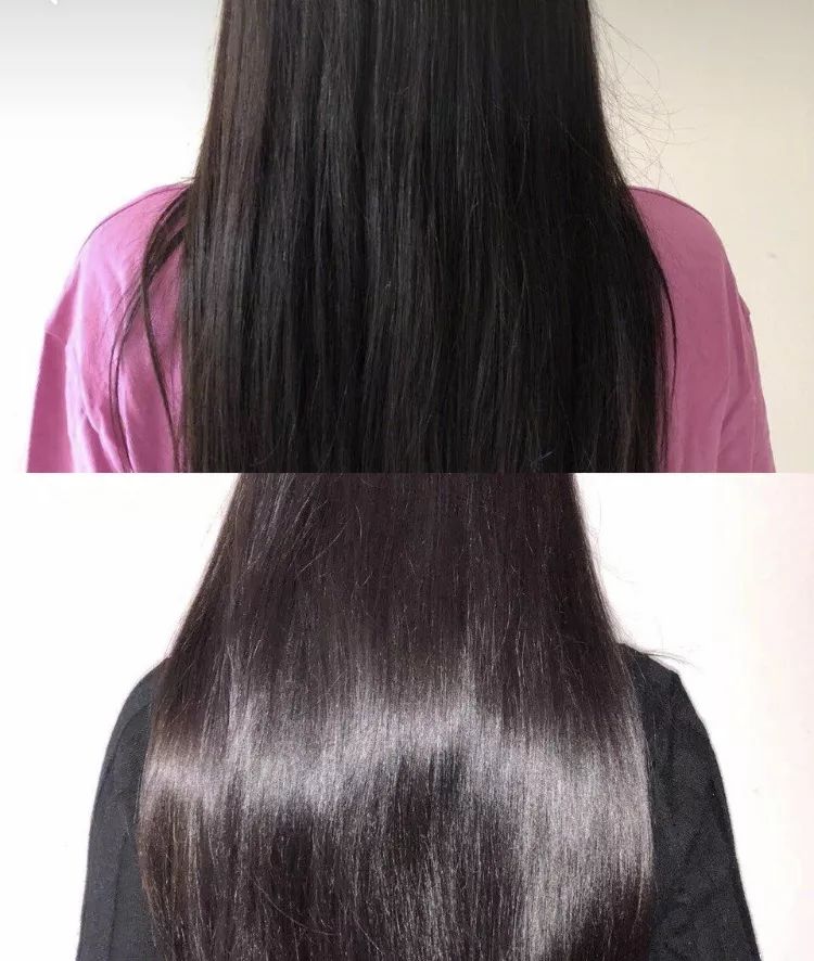 疯狂掉头发发际线后移,疯狂掉头发头发变得稀疏