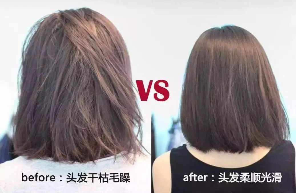 疯狂掉头发发际线后移,疯狂掉头发头发变得稀疏