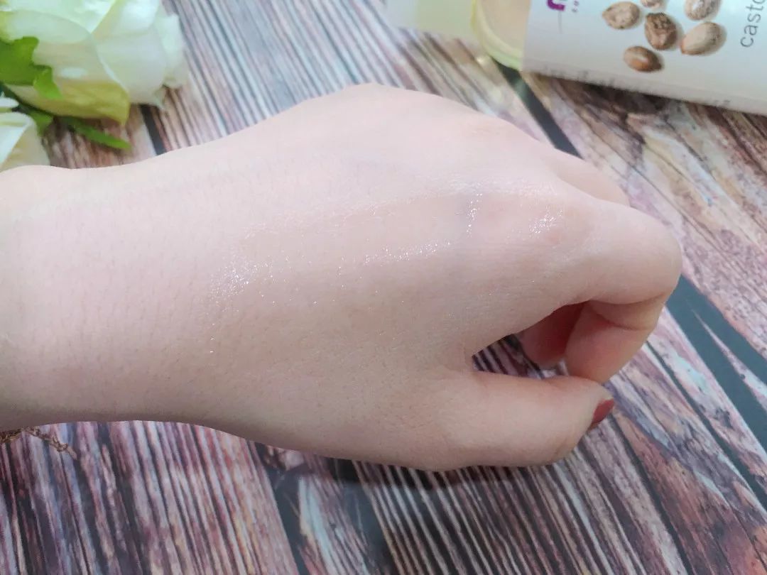 疯狂掉头发发际线后移,疯狂掉头发头发变得稀疏