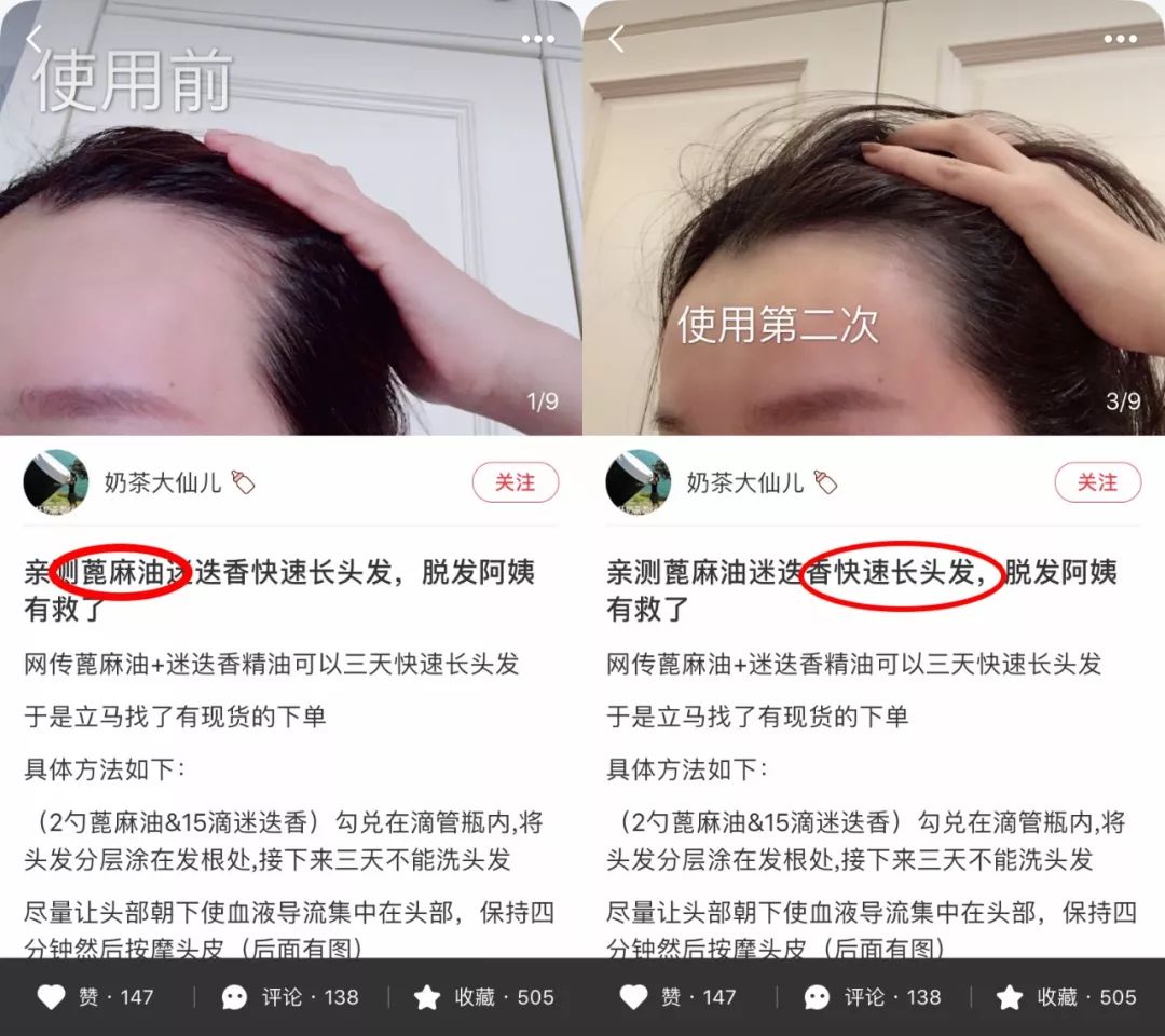 疯狂掉头发发际线后移,疯狂掉头发头发变得稀疏