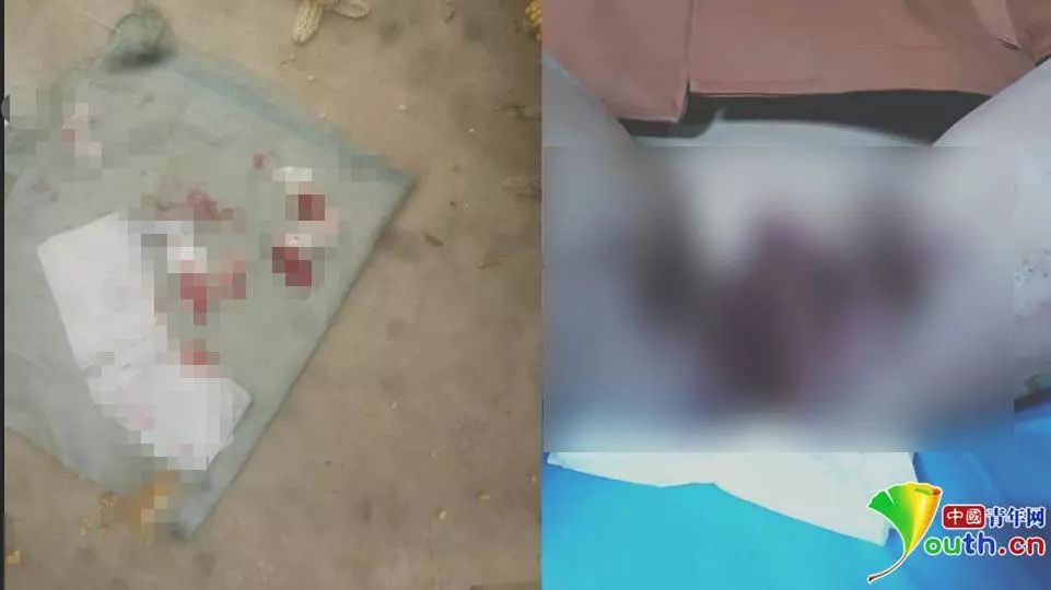 甘肃8岁女生被打致*体下**出血!官方:两名男同学用笤帚把所伤,涉事校长免职