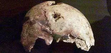 涨知识科普人体骨骼,骨龄鉴定可以改年龄吗